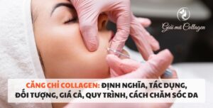 Tìm hiểu về phương pháp cấy chỉ collagen