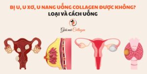 Bị u, u xơ, u nang uống collagen được không? Loại và cách uống Người có khối u uống collagen bổ sung được không?