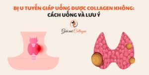 Bị u tuyến giáp uống được collagen không: Cách uống và lưu ý Collagen cho người bị u tuyến giáp