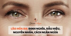 Lão hóa da: Định nghĩa, dấu hiệu, nguyên nhân, cách ngăn ngừa Tìm hiểu về tình trạng lão hoá da
